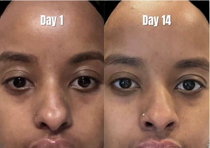 TURMERIC-QASIL AND KOJIC ACID BRIGHTENING BAR